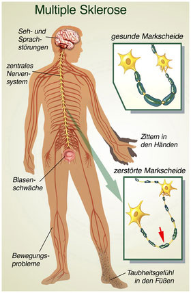 Die Körperpsychotherapie: Behandlung mit Potential oder Humbug?