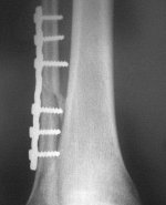 Alt Baldir Sag 03.05.2010.jpg