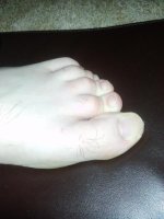 Fuß.jpg Fuß.jpg
